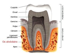 Implantologie dentaire